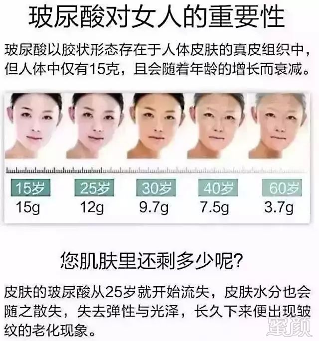https://img.miyanlife.com/mnt/timg/180428/1214004K3-3.jpg