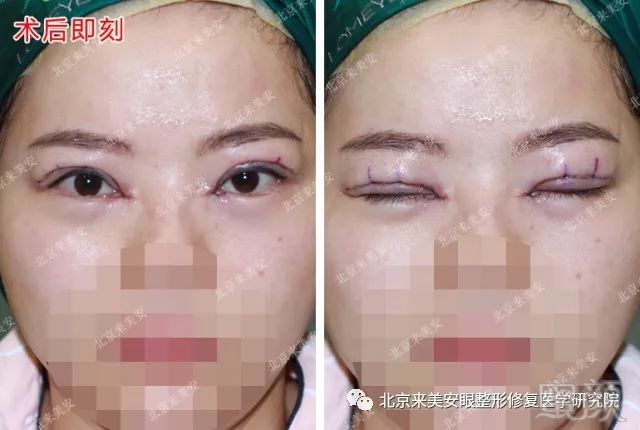 https://img.miyanlife.com/mnt/timg/180428/12140IK4-1.jpg