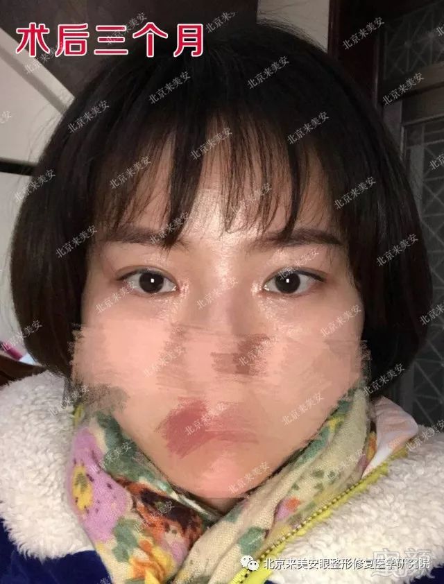 https://img.miyanlife.com/mnt/timg/180428/12140QW0-5.jpg