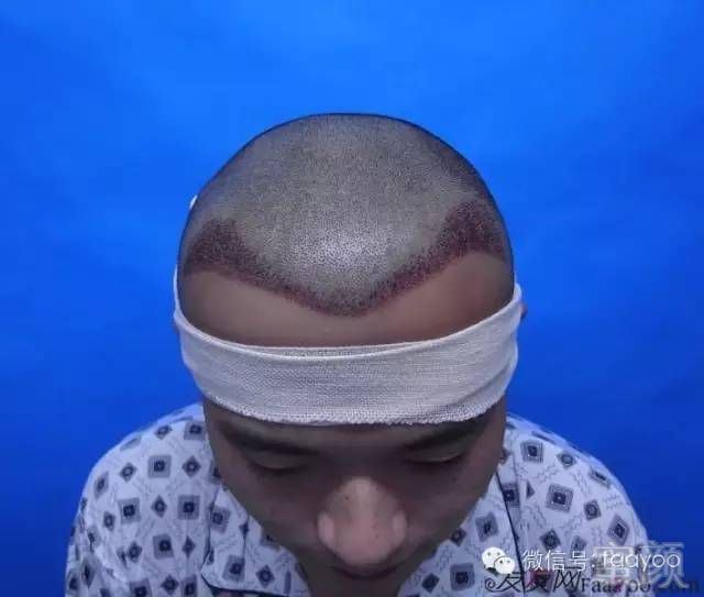 https://img.miyanlife.com/mnt/timg/180428/1219435230-1.jpg