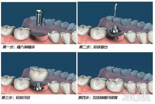 案例图片