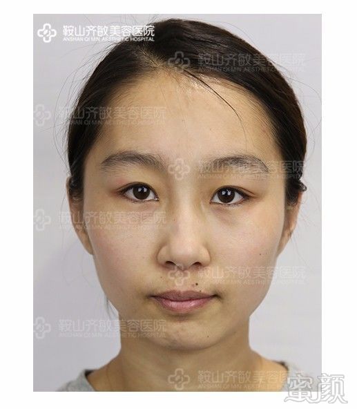 https://img.miyanlife.com/mnt/timg/180429/1255403O3-3.jpg