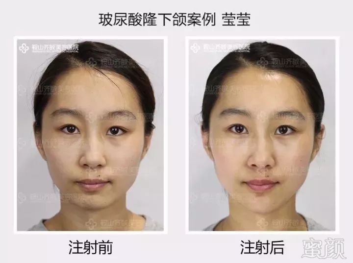 https://img.miyanlife.com/mnt/timg/180429/1255413Z1-5.jpg