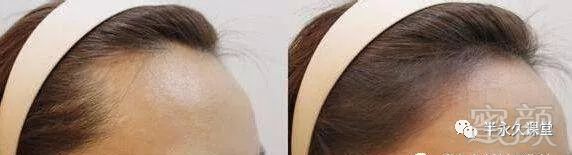 https://img.miyanlife.com/mnt/timg/180429/1259321H7-3.jpg