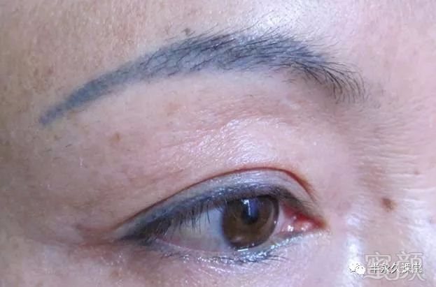 https://img.miyanlife.com/mnt/timg/180429/1259323T5-2.jpg