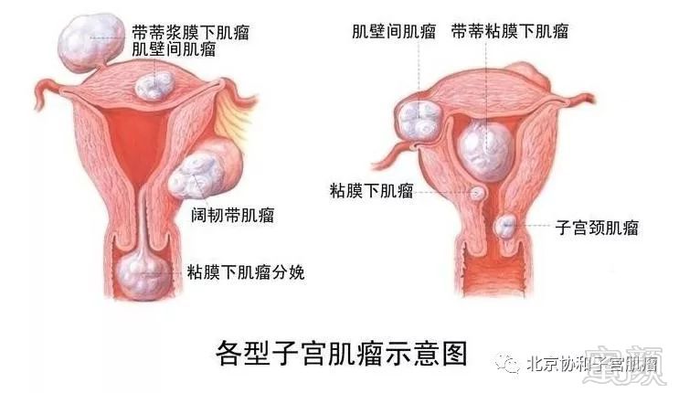 案例图片