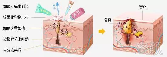 https://img.miyanlife.com/mnt/timg/180429/1310516159-3.jpg