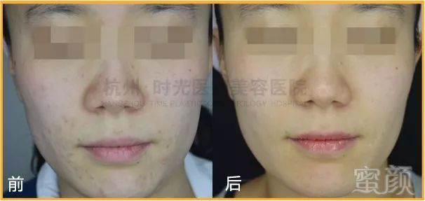 https://img.miyanlife.com/mnt/timg/180429/13105230Z-10.jpg