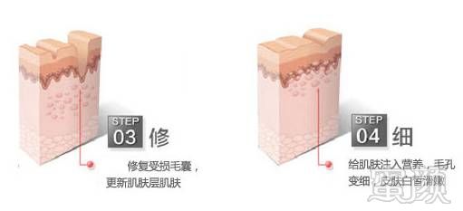 https://img.miyanlife.com/mnt/timg/180429/1310524A4-9.jpg
