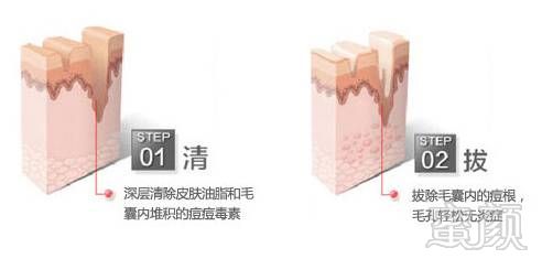 https://img.miyanlife.com/mnt/timg/180429/13105264V-8.jpg