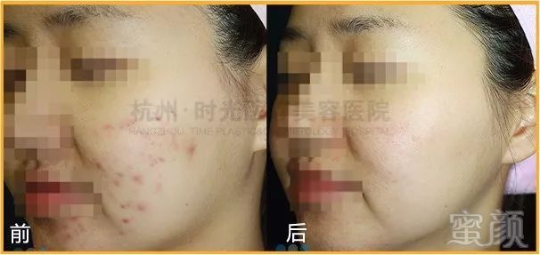 https://img.miyanlife.com/mnt/timg/180429/131053I18-14.jpg