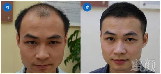 https://img.miyanlife.com/mnt/timg/180429/13324K256-4.jpg