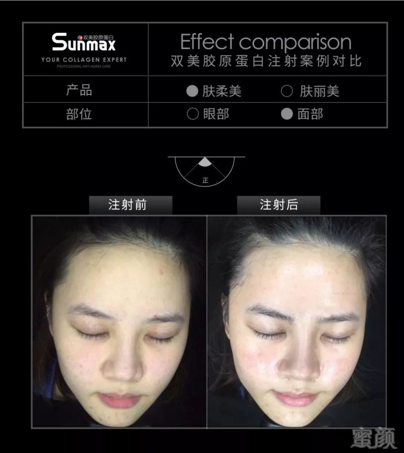 https://img.miyanlife.com/mnt/timg/180429/13533LA9-11.jpg