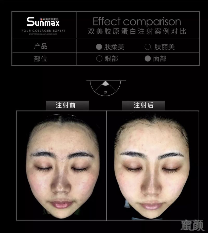 https://img.miyanlife.com/mnt/timg/180429/13533T4D-12.jpg