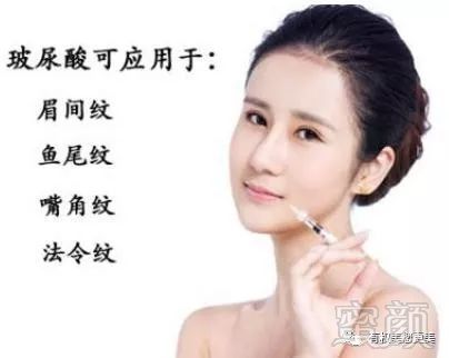 https://img.miyanlife.com/mnt/timg/180429/13594aV5-0.jpg