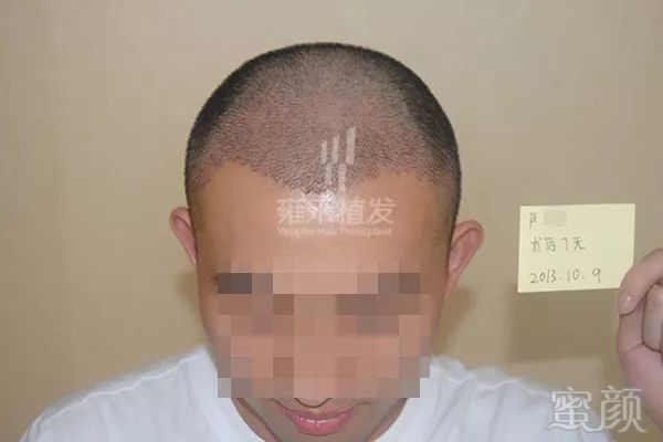 https://img.miyanlife.com/mnt/timg/180430/112T161N-1.jpg