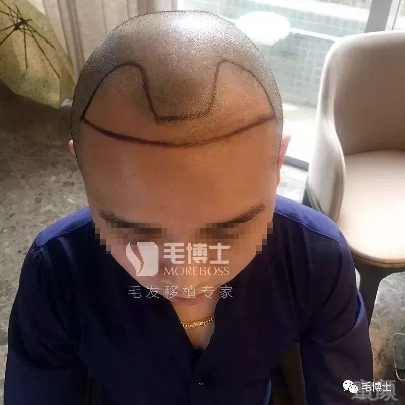 https://img.miyanlife.com/mnt/timg/180430/11561353M-1.jpg
