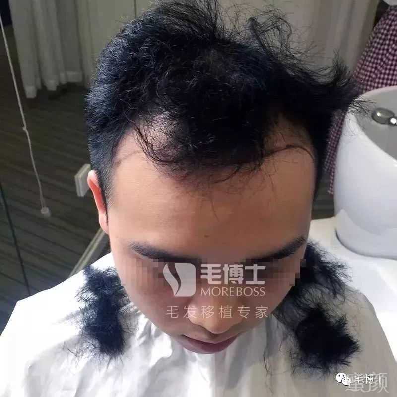 https://img.miyanlife.com/mnt/timg/180430/1156145144-3.jpg
