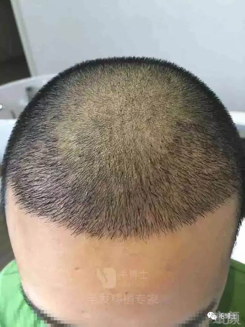 https://img.miyanlife.com/mnt/timg/180430/1156153I1-5.jpg