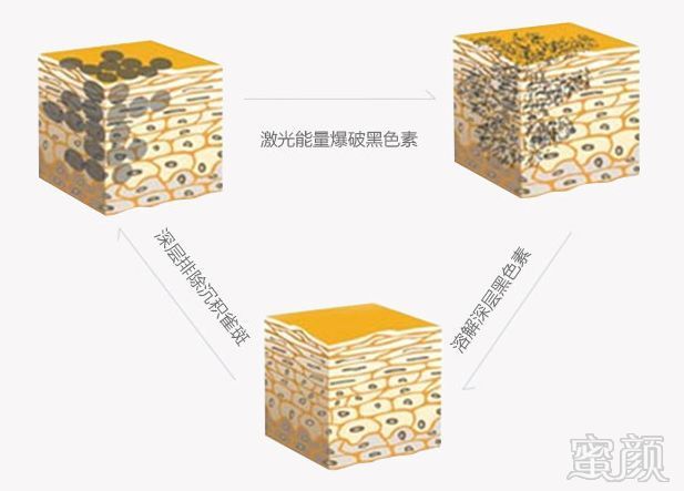 https://img.miyanlife.com/mnt/timg/180430/1243223T9-2.jpg