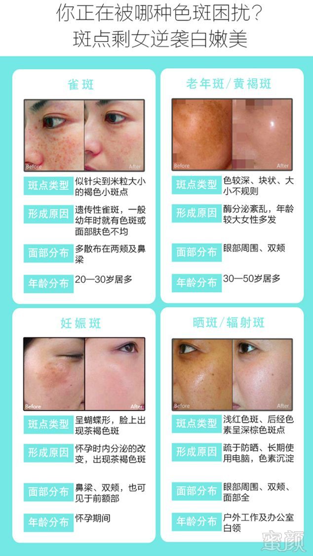 https://img.miyanlife.com/mnt/timg/180430/1243231095-3.jpg