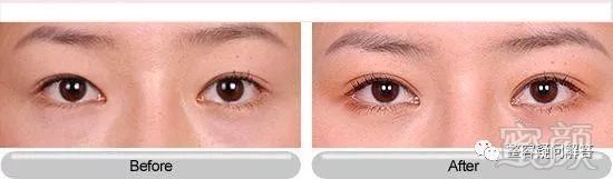 https://img.miyanlife.com/mnt/timg/180430/1344145Q5-1.jpg