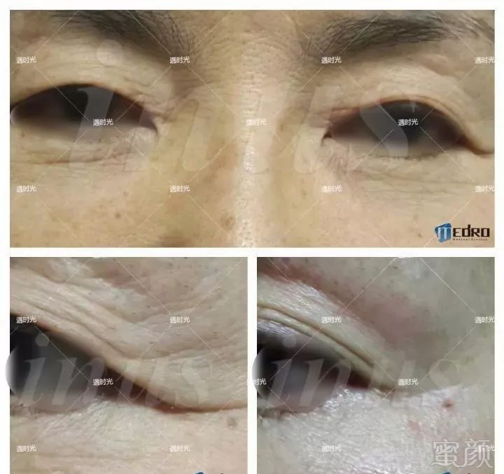 https://img.miyanlife.com/mnt/timg/180430/1351446310-12.jpg