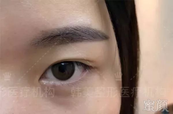 https://img.miyanlife.com/mnt/timg/180501/1101454143-1.jpg