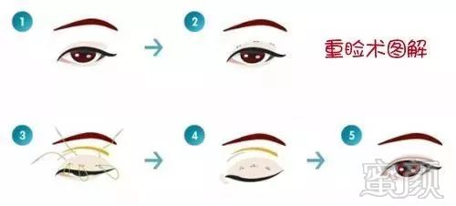 https://img.miyanlife.com/mnt/timg/180501/1101455460-3.jpg