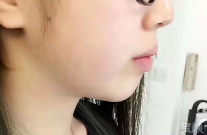 https://img.miyanlife.com/mnt/timg/180501/1101463961-9.jpg