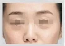 https://img.miyanlife.com/mnt/timg/180501/1101463E9-6.jpg