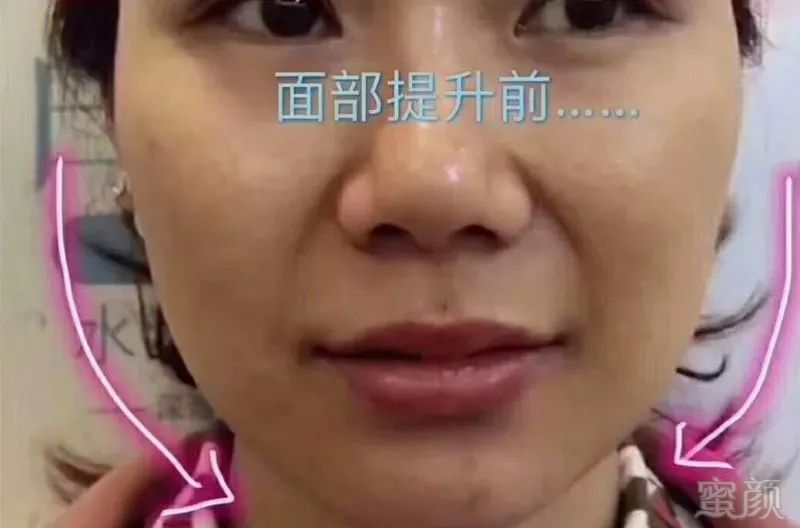 https://img.miyanlife.com/mnt/timg/180501/11014H593-12.jpg