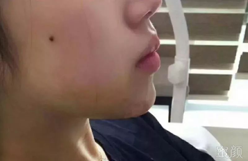 https://img.miyanlife.com/mnt/timg/180501/11014H614-10.jpg