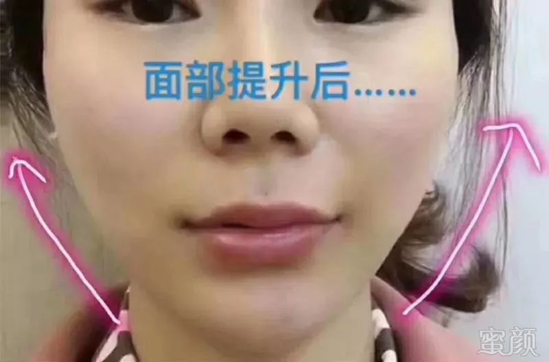 https://img.miyanlife.com/mnt/timg/180501/11014T559-13.jpg