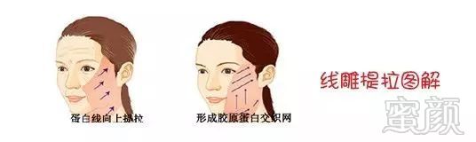 https://img.miyanlife.com/mnt/timg/180501/11014U117-14.jpg