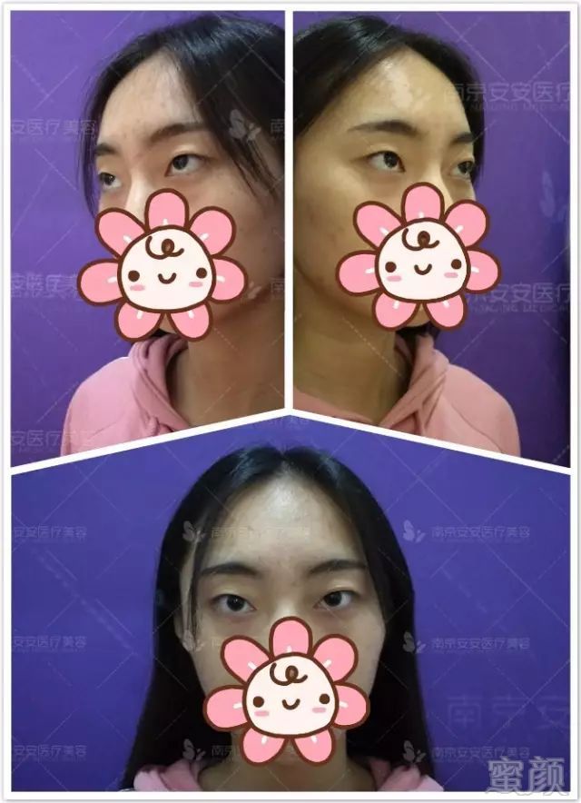 https://img.miyanlife.com/mnt/timg/180501/11033440C-1.jpg