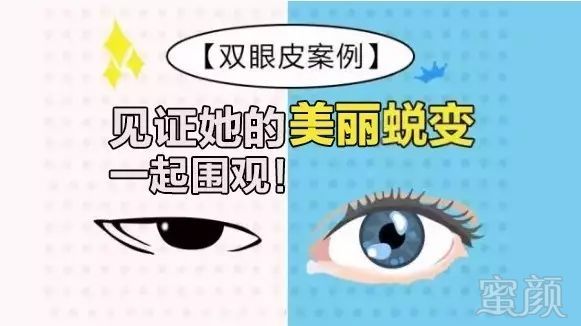 https://img.miyanlife.com/mnt/timg/180501/11033442L-0.jpg