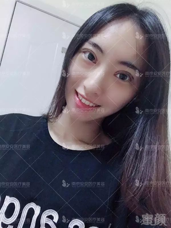 https://img.miyanlife.com/mnt/timg/180501/1103364A1-9.jpg