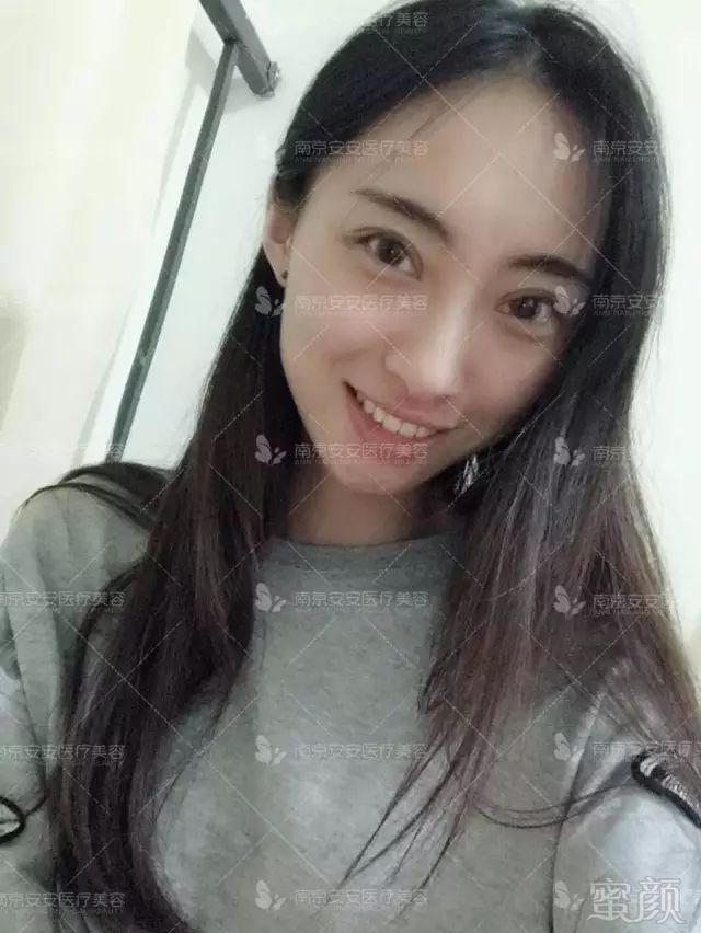 https://img.miyanlife.com/mnt/timg/180501/11033H341-12.jpg