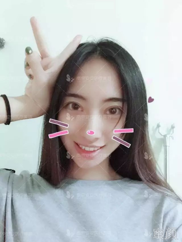 https://img.miyanlife.com/mnt/timg/180501/11033KP3-11.jpg