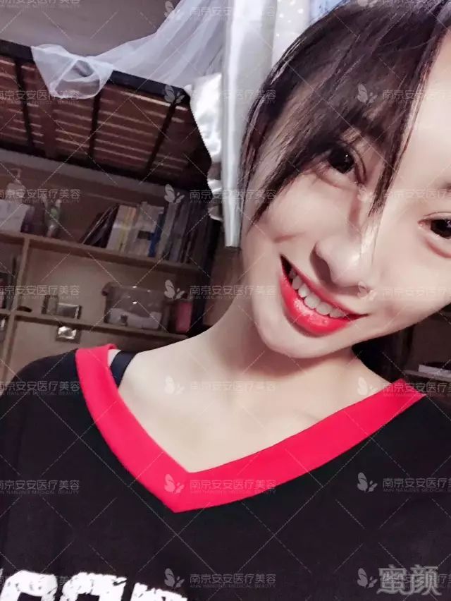https://img.miyanlife.com/mnt/timg/180501/11033S3I-14.jpg