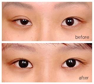 https://img.miyanlife.com/mnt/timg/180501/110P24H7-4.jpg