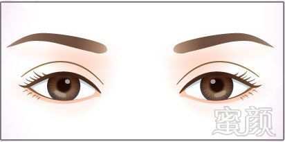 https://img.miyanlife.com/mnt/timg/180501/110P26032-0.jpg