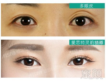 https://img.miyanlife.com/mnt/timg/180501/110P34518-8.jpg
