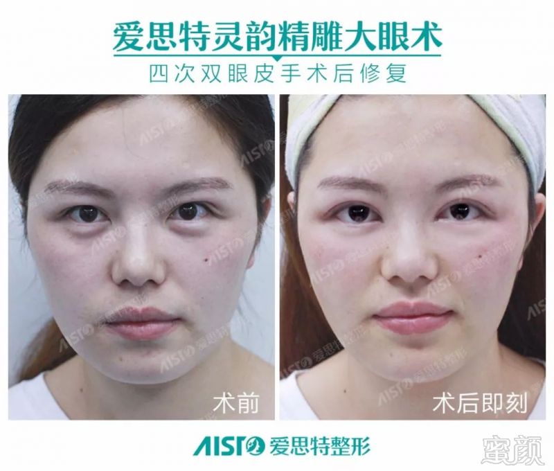 https://img.miyanlife.com/mnt/timg/180501/110P41V4-13.jpg