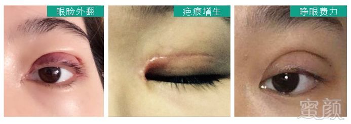 https://img.miyanlife.com/mnt/timg/180501/110P45012-12.jpg