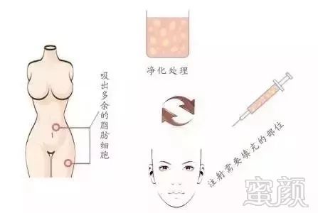 https://img.miyanlife.com/mnt/timg/180501/1125091N3-10.jpg