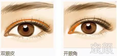https://img.miyanlife.com/mnt/timg/180501/11262Q462-4.jpg