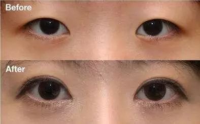 https://img.miyanlife.com/mnt/timg/180501/11262V4c-5.jpg