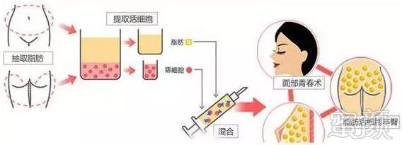 https://img.miyanlife.com/mnt/timg/180501/11262a131-9.jpg